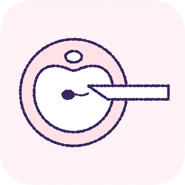 体外受精、顕微授精のイメージイラスト